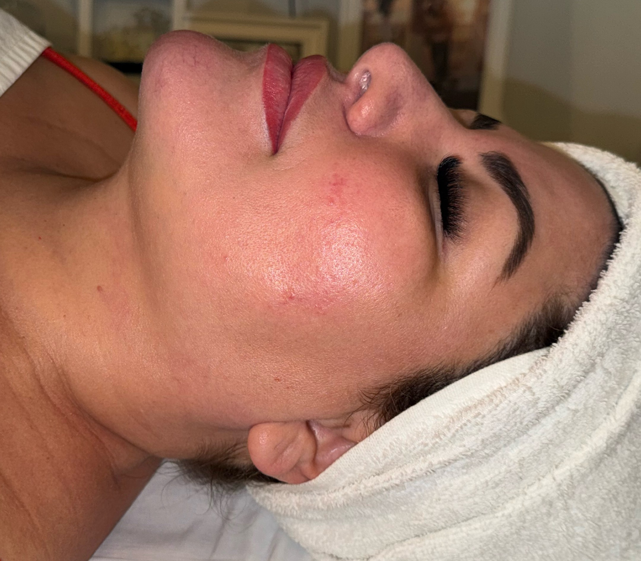 Depois – Miracle Touch